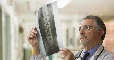 Calcification - Symptoms, Causes, Treatments